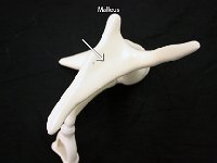 25 Malleus : malleus, hammer, tympanic membrane, ear anatomy