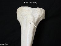 26 Tuberal tuberosity : tibial tuberosity, tibia, muscle attachment, lower limb