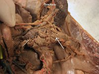 27 Pancreas : pancreas, abdomen, cat digestive system