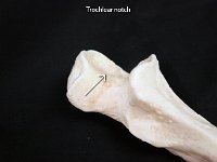 27 Trochlear notch : trochlear notch, trochlear of the humerus, upper limb