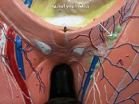 28 Inguinal lymph nodes : inguinal lymph nodes, pelvis, lymphatic system