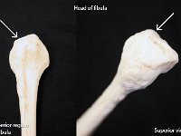 29 Head of fibula-01 : head of fibula, fibula, lower limb