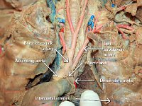 29 brachiocephali-intercostal-subclavian arteries-aortic arch-descending aorta-01 : aortic arch, ascending aorta, descending aorta, intercostal arteries, left subclavian artery, brachiocephalic artery