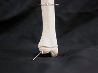 30 Head of the ulna-01 : head of ulna, distal, wrist joint, upper limb