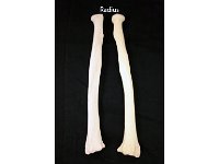 31 Radius : radius, forearm, ulna, upper limb