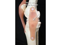 32 Tibial collateral ligament : tibial collateral ligament, knee, medial, lower limb