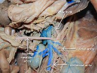 33 Celiac trunk-Renal artery-abdominal aorta-superior mesenteric artery : celiac trunk, renal artery, abdominal aorta, superior mesenteric artery