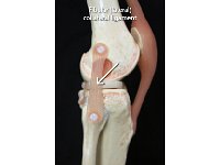 33 Fibular collateral ligament : fibular collateral ligament, knee, lateral, lower limb
