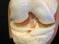 34 Anterior cruciate ligament : anterior cruciate ligament, knee joint, cranial cruciate ligament, lower limb