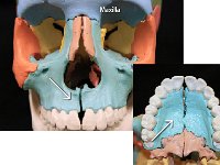 34 Maxilla : maxilla, upper palate, facial bone, skull