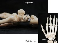 34 Triquetrum-01 : triquetrum, proximal row, posterior region, hand bone