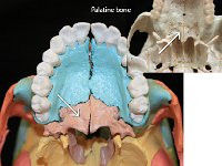 34.5 Palatine bone-01 : palatine bone, nasal cavity, facial bone, skull