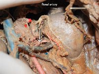 35 Celiac trunk : renal artery, abdominal aorta, blood, kidneys, cat circulatory system