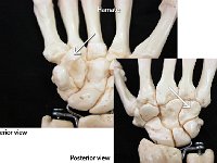 36 Hamate : hamate, medial bone, distal row, hand bone
