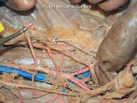 36 Inferior mesenteric artery : inferior mesenteric artery, abdominal aorta, blood, cat circulatory system