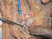 37 Internal-external iliac artery : internal iliac artery, external iliac artery, pelvic region, cat circulatory system