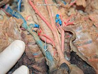 39 Superior vena cava : superior vena cava, superior heart region, heart, cat circulatory system