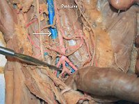 42 Post cava : postcava, abdominal cavity, cat circulatory system