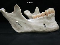 41 Ramus : ramus, mandible, facial bone, skull