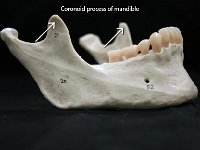 42 Coronoid process of mandible : coronoid process of the mandible, mandible, fangs, facial bone, skull, coronoid process of mandible