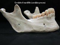 43 Condyle of mandible : condylar process, mandible, facial bone, skull, condyle of mandible