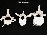 44 Body of vertebra : body of vertebra, disk shaped, vertebrae, dorsal