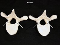 45 Pedicle-01 : pedicle, bride, vertebrae, dorsal