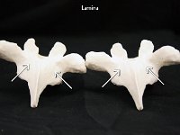 46 Lamina : lamina, bridge, vertebrae, dorsal
