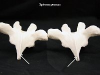 48 Spinous process-01 : spinous process, muscle attachment, vertebrae, dorsal
