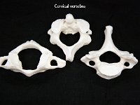 49.5 Cervical vertebra : cervical vertebra, spinal cord, vertebrae, dorsal