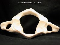 49.75 Cervical vertebra : atlas, cervical vertebra, vertebrae, dorsal