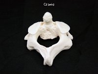 52 C2 Axis : axis, cervical vertebrae, vertebrae, dorsal, c2 (axis)