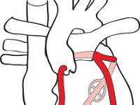 Cardiovascular System, coronary arteries