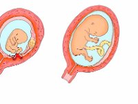 General Baby Venous System Development  human development, venous, uterus : human development, venous, uterus
