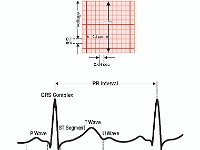 Electrocardiogram Output and Voltage  QRS Complex, ECG, T wave, U wave, P wave, Voltage, time, ST segment : QRS Complex, ECG, T wave, U wave, P wave, Voltage, time, ST segment