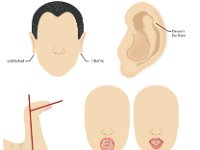 Phenotypes of Human Features  ears, attached, unattached, thumb, tongue, darwin's ear point : ears, attached, unattached, thumb, tongue, darwin's ear point