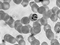 Plasmodium 1000x  eukaryotic cells, parasite : eukaryotic cells, parasite