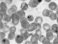 Plasmodium 1000x2  eukaryotic cells, parasite : eukaryotic cells, parasite