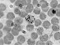 Plasmodium 1000x3  eukaryotic cells, parasite : eukaryotic cells, parasite