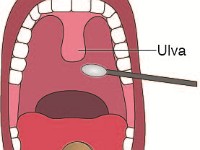 Throat Swab  saliva, swap, germ, bacteria, virus, ulva, mouth, tongue, depressor, specimen, test, cotton